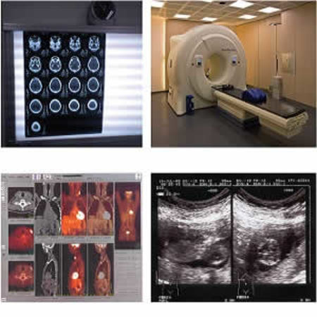 Mitigating radiation risk in medical imaging: expert opinion