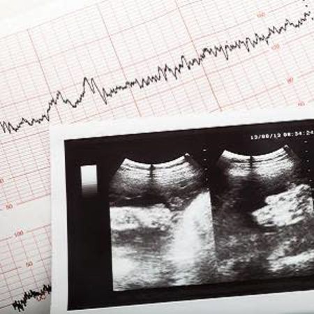 Implementing a software solution across multiple ultrasound vendors