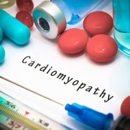 Treatment withdrawal for heart failure in patients with recovered dilated cardiomyopathy