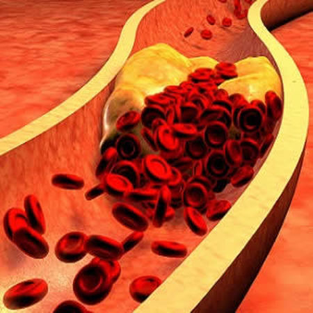 Discordance between ESC guidelines and actual treatment of CAD 