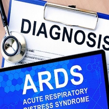 Cognitive Impairment After ARDS