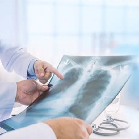 Diagnostic Test Accuracy of CXR, CT, Ultrasound in COVID-19 Patients