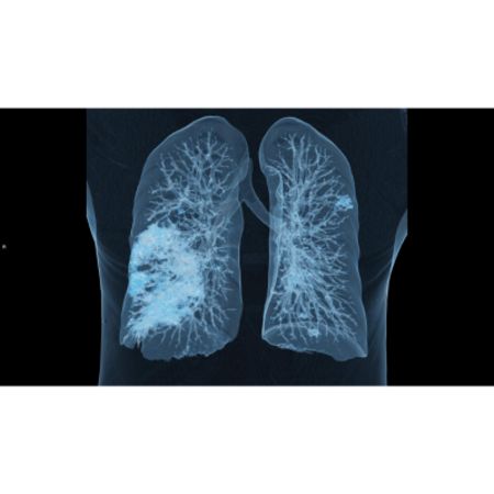 When COVID-19 Strikes, We Learn From The Traces It Leaves Behind