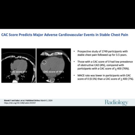 Coronary Artery Calcium Score Could be Predictor of Heart Attacks &amp; Strokes