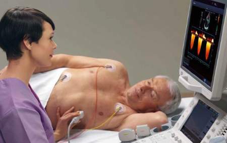 Toshiba Cardiac Ultrasound Top in KLAS  