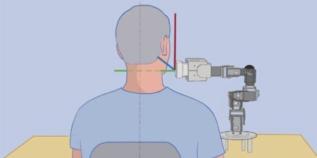 Robotic-Assisted Ultrasound Imaging