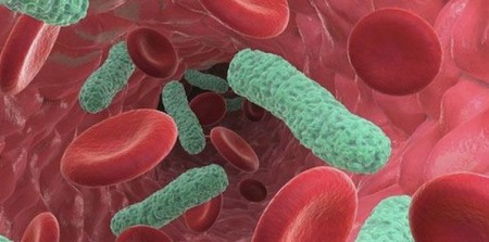 Study Uncovers Genetic Evidence: Sepsis Caused by Single Bacteria 