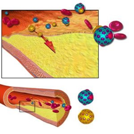 Paediatric Cholesterol Guidelines for Young Adults Increase Statin Use