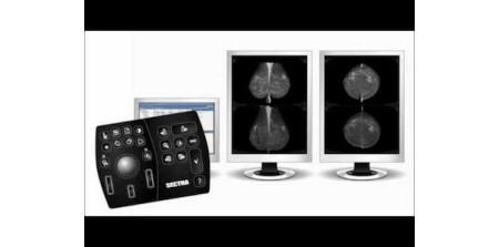 Northern Ireland Expands Sectra PACS Contract to Include Digital Breast Imaging