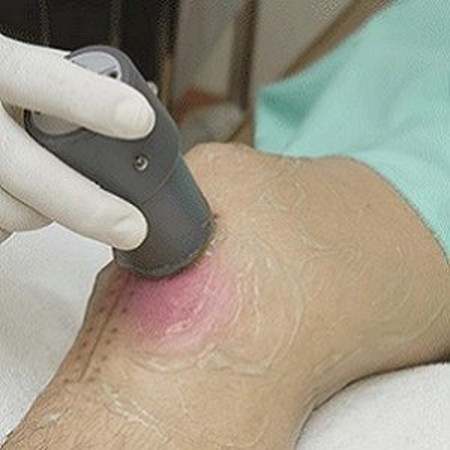 skin wound treatment using ultrasound