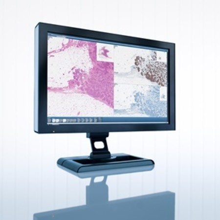 University hospital in Finland Invests in Digital Pathology from Sectra