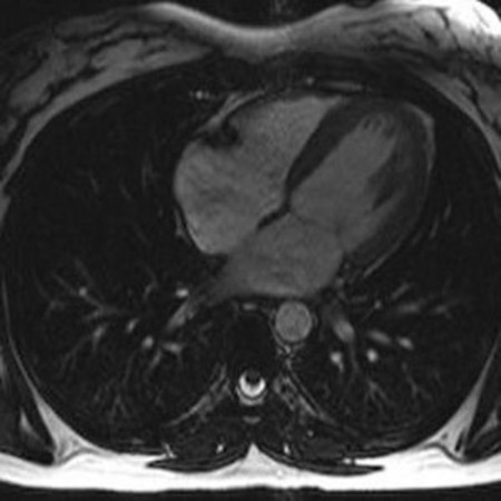 New Cardiac Imaging Technique Improves Accuracy 