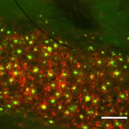 Brain section of a transgenic mouse for AD showing accumulations of amyloid plaques (green) and ferritin (red).