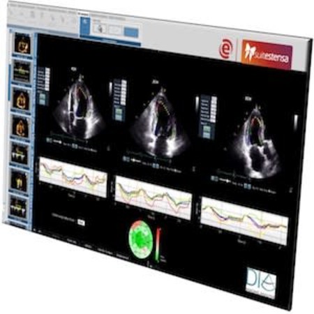 Ebit &amp; DiA Imaging Analysis partner offering Advanced AI-based Cardiac Ultrasound Analysis 