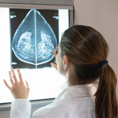 Dense breasts, breast cancer risk, and screening choices in 2019 