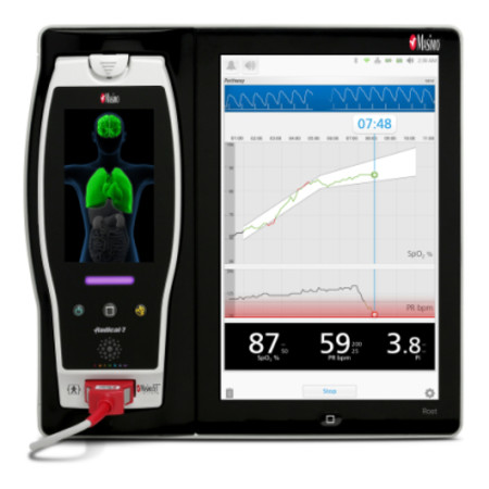 Masimo Announces Pathway&trade;, A Newborn Oxygenation Visualization Mode For The Root&reg; Patient Monitoring And Connectivity Platform 