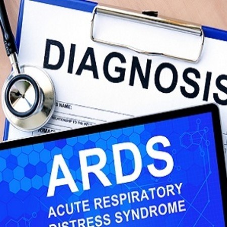 Cognitive Impairment After ARDS