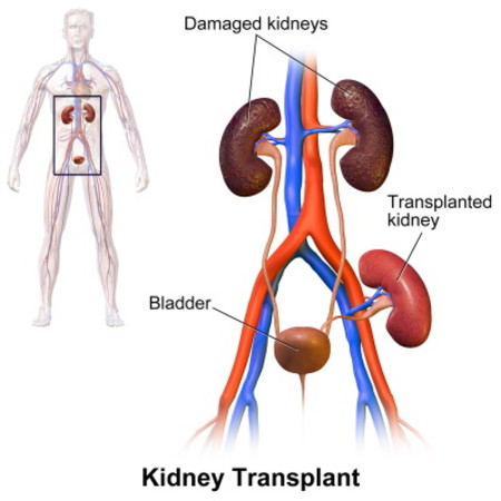 England to Introduce Deemed Consent for Organ Donation