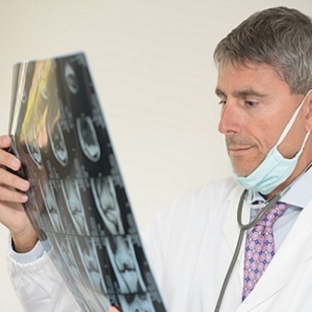 Imaging Manifestations of COVID-19 vs. MERS/SARS