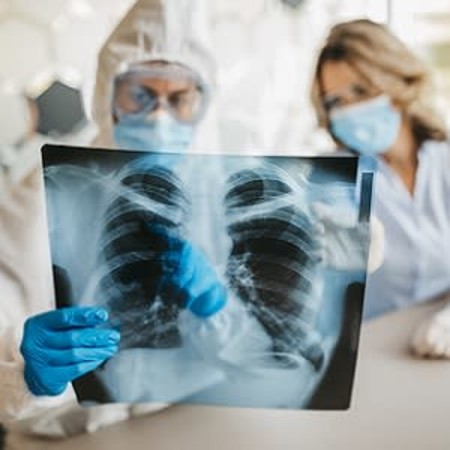 Lung Histopathology: COVID-19 Compared to SARS, H1N1