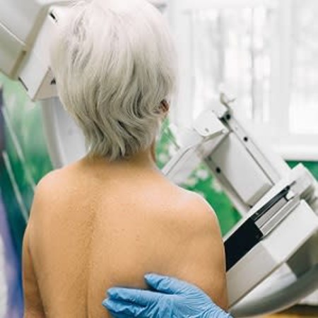 Mammography Screening Guidelines for Older Survivors of Breast Cancer