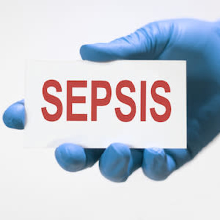Antibiotic Delay Intervals, Mortality Among Patients With Suspected Sepsis 