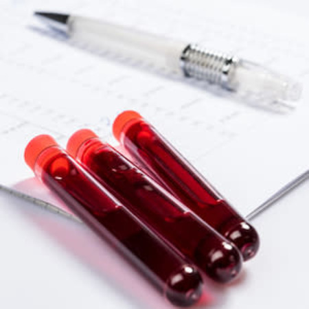 Pancreatic Stone Protein Testing Reduces Expenditure in&nbsp;Sepsis