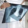 Enhancing Pulmonary Embolism CT Detection Through AI 