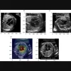 Collaborative Role of AI and US Clinicians in Detecting Congenital Heart Defects