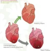 RESILIENCE: Remote Ischaemic Conditioning for Prevention of Anthracycline Cardiotoxicity