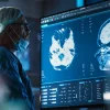 A surgeon&nbsp;reviews&nbsp;brain&nbsp;MRI on a large digital monitor&nbsp;