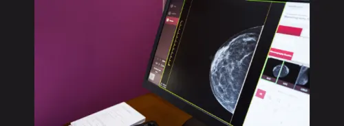 Potential of CEM and Integrated Imaging Modalities in Breast Cancer Staging