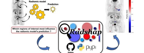 RadShap Tool Uses Shapley Values for Multiregion Radiomic Model Predictions 