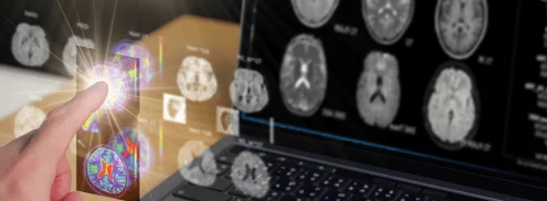 Enhancing Diagnostic Brain CT Referral Justification with AI