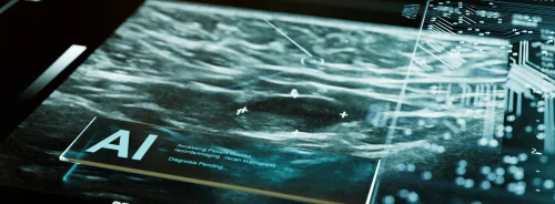 DLIR&#039;s Impact on Coronary Artery Calcium Scoring and Dose Reduction