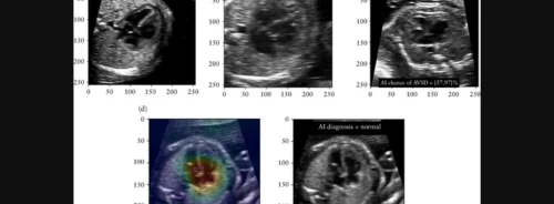 Collaborative Role of AI and US Clinicians in Detecting Congenital Heart Defects