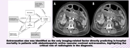 Predicting In-Hospital Mortality in AVCE Patients on Abdominopelvic CT