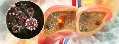 Hepatocellular Carcinoma Prognosis with Machine Learning-Based Radiomics