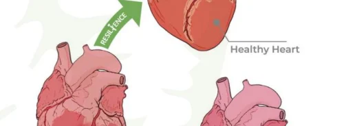 RESILIENCE: Remote Ischaemic Conditioning for Prevention of Anthracycline Cardiotoxicity