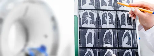 Radiologist reviewing CT lung scan images in front of CT scanner for chest disease and lung cancer diagnosis.&nbsp;