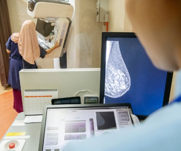 USPSTF Breast Cancer Screening Recommendations Shifts Towards Earlier Screening