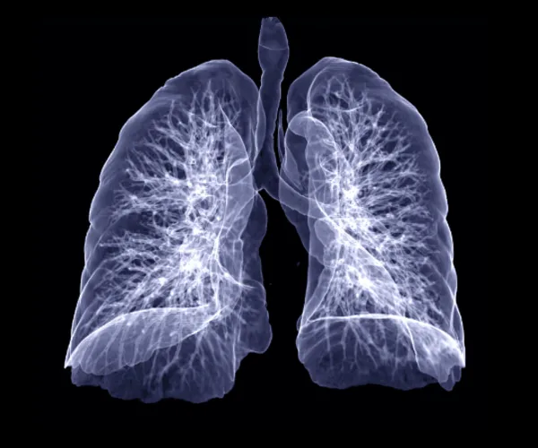 How to Better Manage Subsolid Lung Nodules?