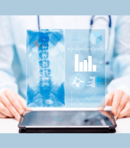 Using ChatGPT to Structure Data from Mechanical Thrombectomy Radiology Reports