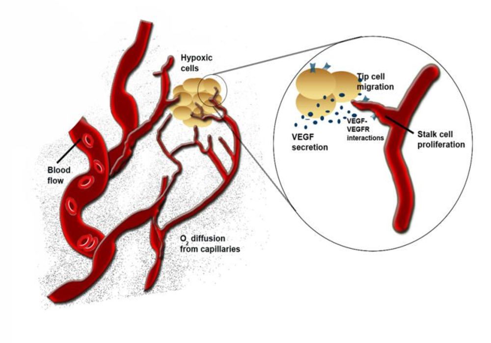How Blood Vessels Regroup After Stroke
