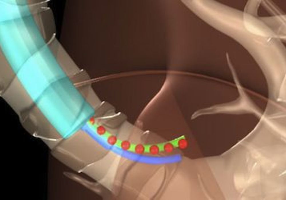 Researchers Devise X-ray Approach to Track Surgical Devices  