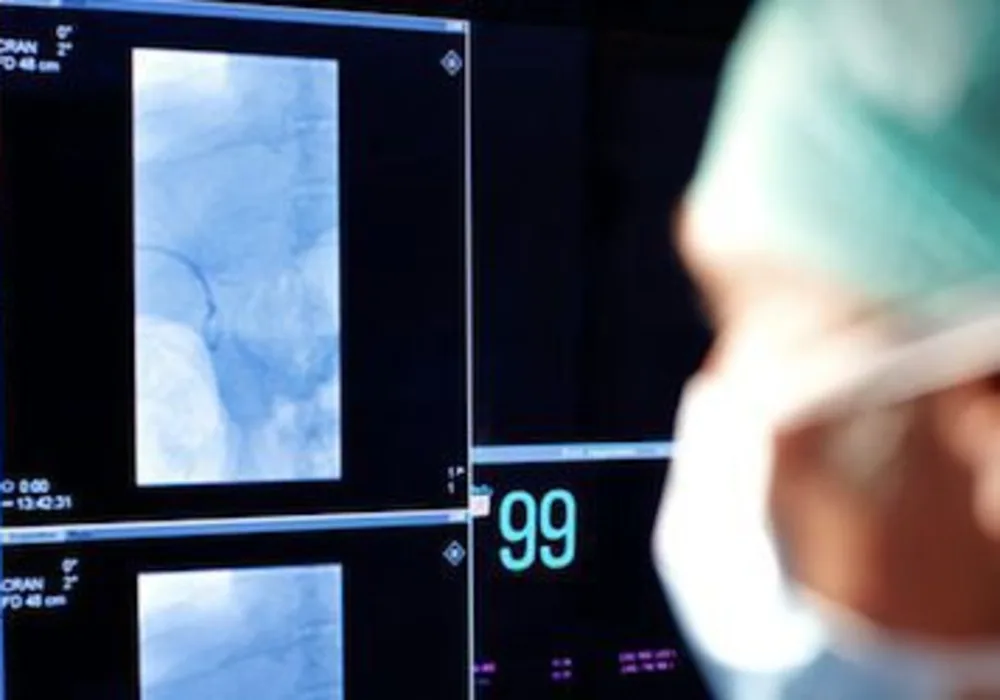 Dose Reduction with High Image Quality with Philips X-ray System for Cardiac Interventions 