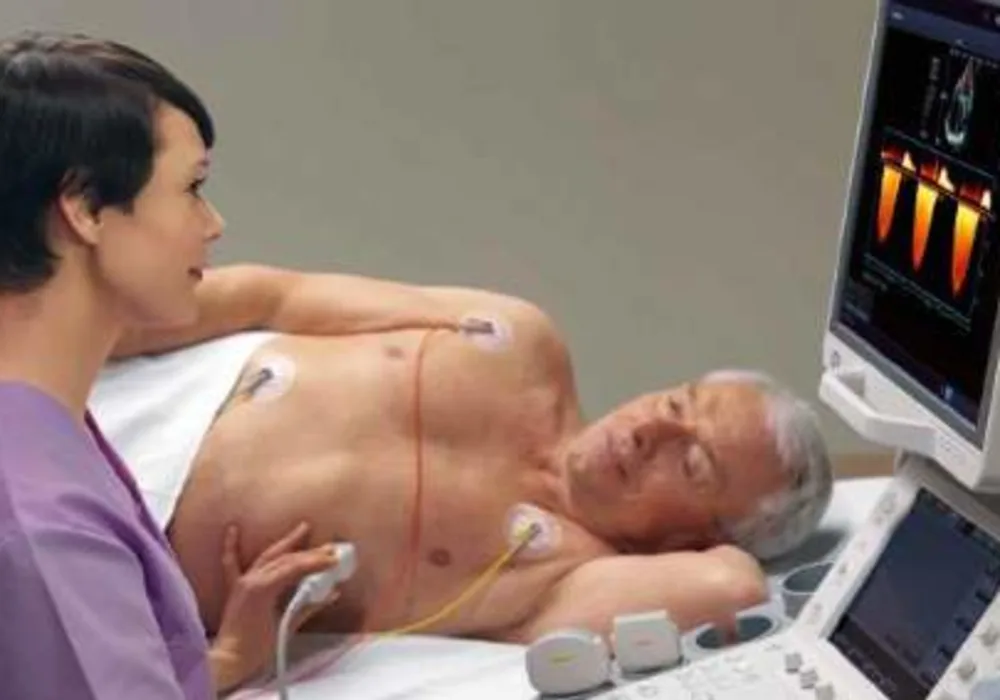 Toshiba Cardiac Ultrasound Top in KLAS  