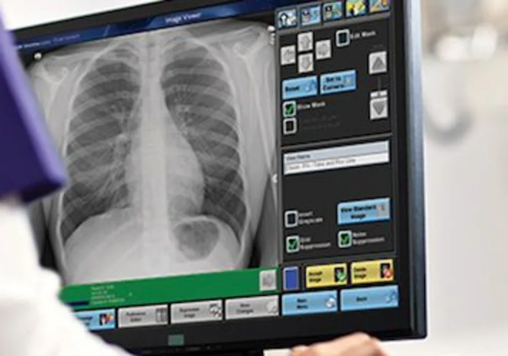 Carestream Digital X-ray System Receives Top Award  