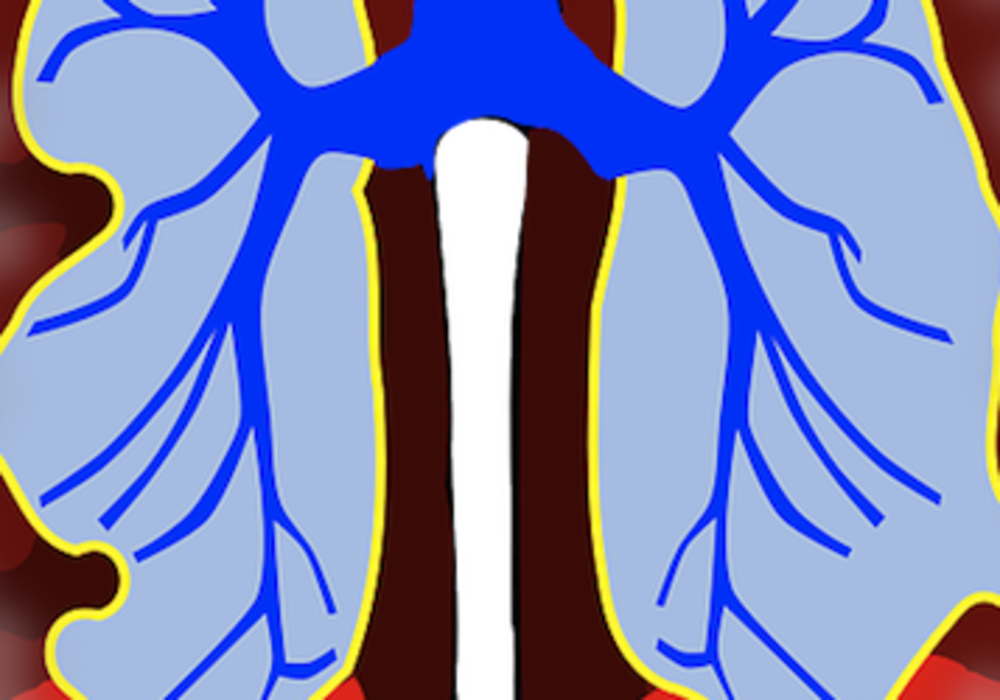 Screening for Lung Cancer: The NELSON study