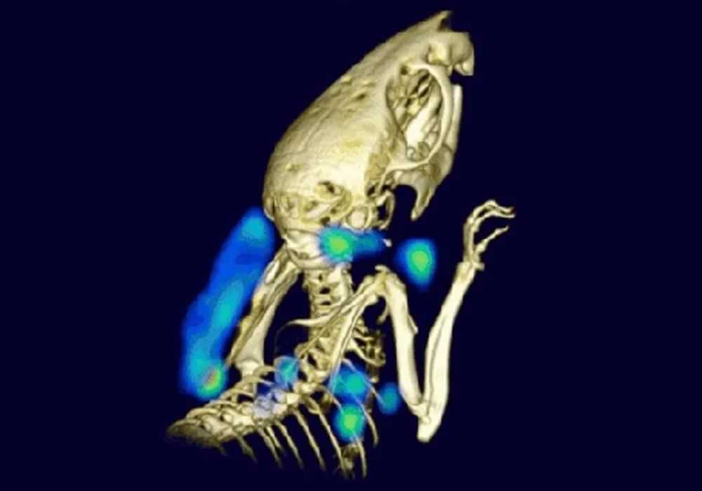 Noninvasive Imaging of Immune System Detects Tumours